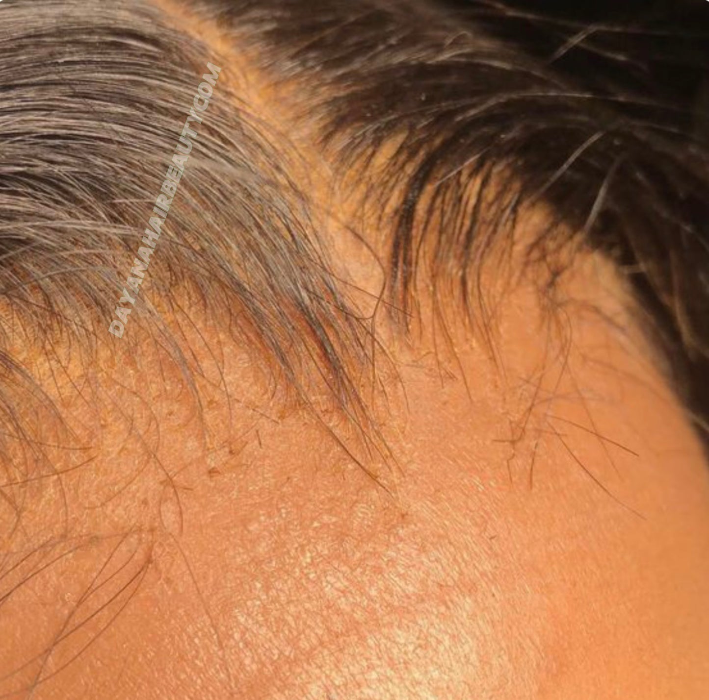 FRONTALE RAW INDIEN BODY WAVE